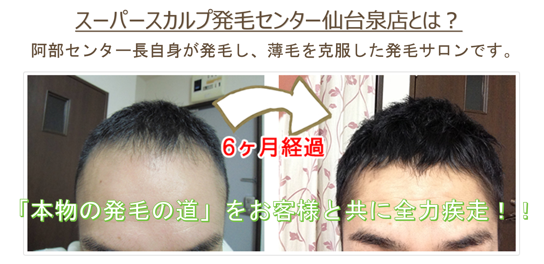 今日のサロン日記　「仙台市３０代女性、朝一番のお試し体験コースで頭皮汚れに大ショック！？」