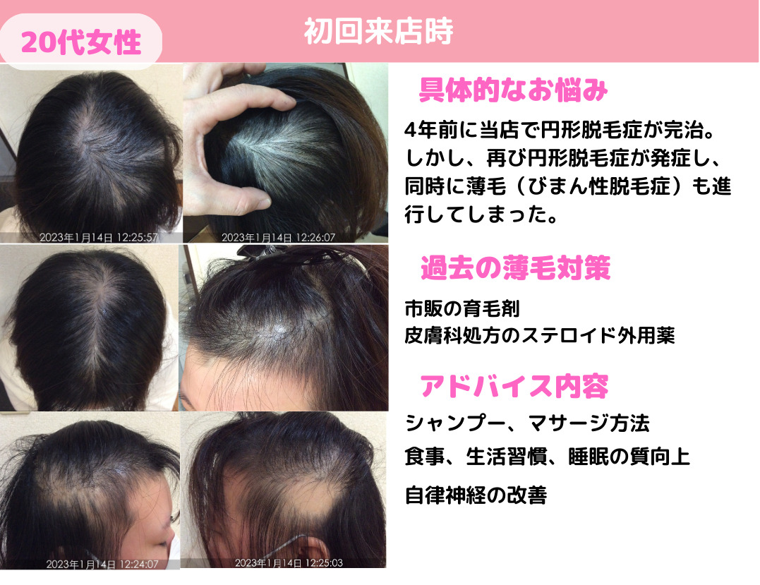 避けるべき食品