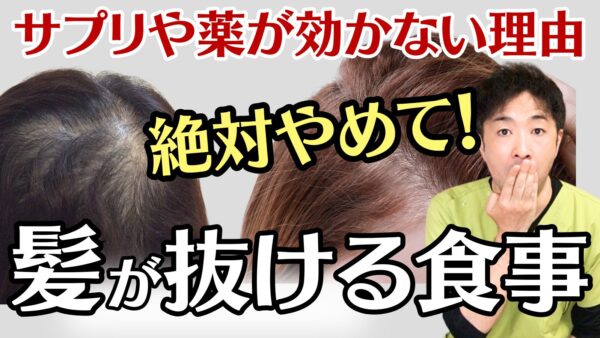 【女性の薄毛対策】サプリや薬で生えない原因はコレ！9割が知らない2つの食事の問題点