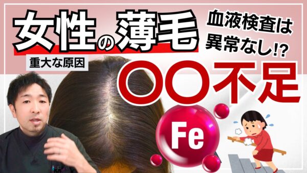 【貧血×薄毛】女性の抜け毛は鉄不足が原因かも？発毛専門家が教えるセルフケア3選